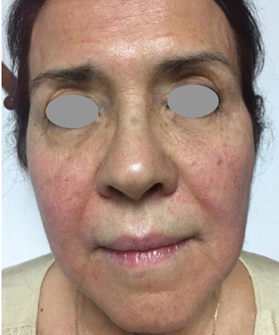 Post - Case 1