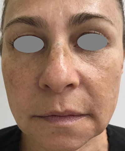 Post - Case 2