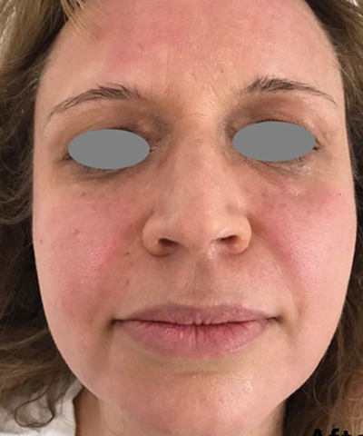 Post - Case 4